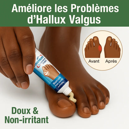 Pommade apaisante pour confort des pieds et orteils (hommes & femmes)